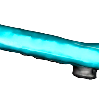 side view of the finalized smoothed version of switch controller